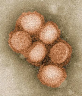 Chile konfirmasi 33 orang tewas akibat H1N1