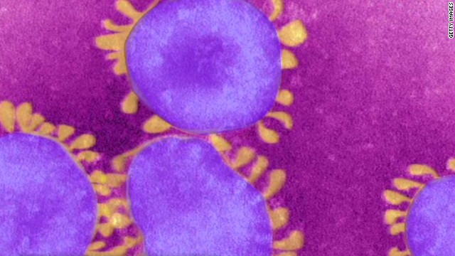 Satu lagi pria Saudi meninggal akibat virus MERS