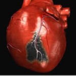 4 Kebiasaan Ini Libas Peluang Sakit Jantung dan Kematian Dini Hingga 80%