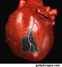 4 Kebiasaan Ini Libas Peluang Sakit Jantung dan Kematian Dini Hingga 80%
