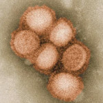 Chile konfirmasi 33 orang tewas akibat H1N1