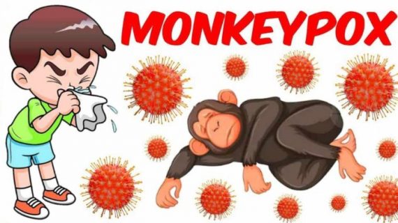 Pemkot Surabaya siapkan ruang isolasi di RS Soewandhie demi antisipasi Monkeypox